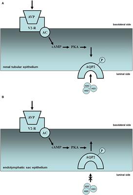 Endolymphatic Sac Drainage Surgery and Plasma Stress Hormone Vasopressin Levels in Meniere's Disease